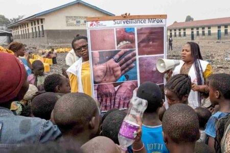l’épicentre de la résurgence du virus mpox en RDC