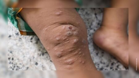 une première livraison de vaccins attendue jeudi en RDC