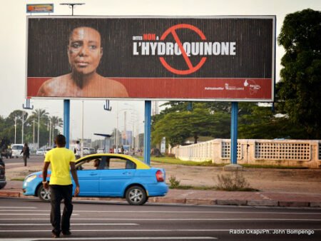 Phénomène «tshoko»: tenue de la peau claire plus?